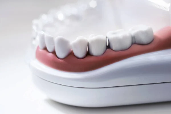 Dental model and dental equipment on white background, concept medical image of dental healtcare, dental hygiene