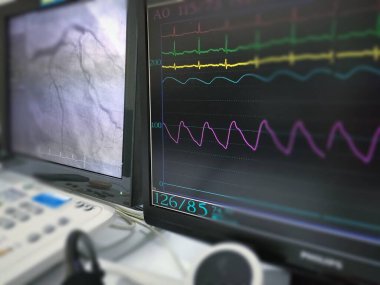 Kateterizasyon laboratuarında, hastanın hayati belirtilerini ve koroner sonuçlarını gösteren birden fazla monitör vardı. Görüntünün merkezine odaklan, diğer kısımlar bulanıklaşır.
