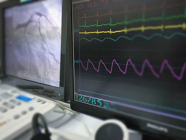 Catheterization Laboratory Were Multiple Monitors Showed Vital Sign Coronary Result — Stock Photo, Image