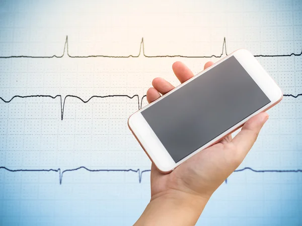 Smartphone on hand with electrocardiogram — Stock Photo, Image