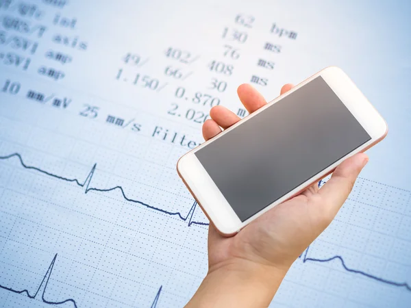 Smartphone on hand with electrocardiogram — Stock Photo, Image