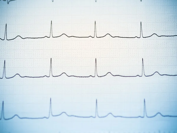 Fechar de um eletrocardiograma . — Fotografia de Stock