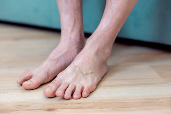 Cropped photo of a barefooted male Caucasian person. Feet near the bed
