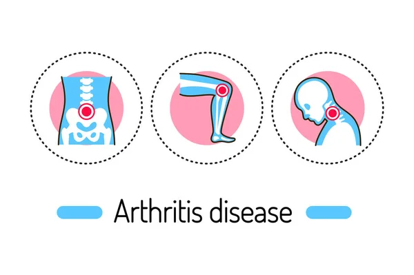 Arthrite Maladie Esquisse Concept Inflammation Articulations Ligne Icônes Couleur Pictogrammes — Image vectorielle