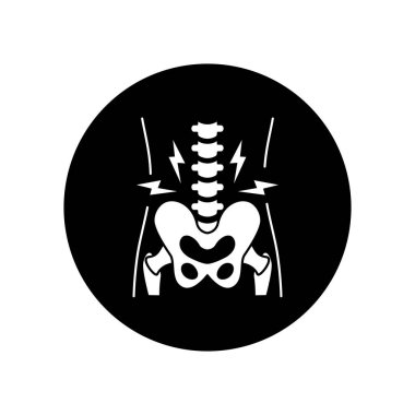 Pelvik artrit siyah glyph ikonu. İltihaplı eklem. Web sayfası, mobil uygulama, düğme, logo için imzala