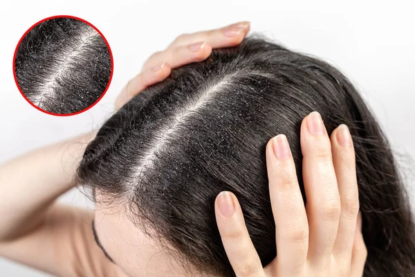 Wanita Itu Memegang Kepalanya Dengan Tangannya Menunjukkan Perpisahan Rambut Hitam — Stok Foto