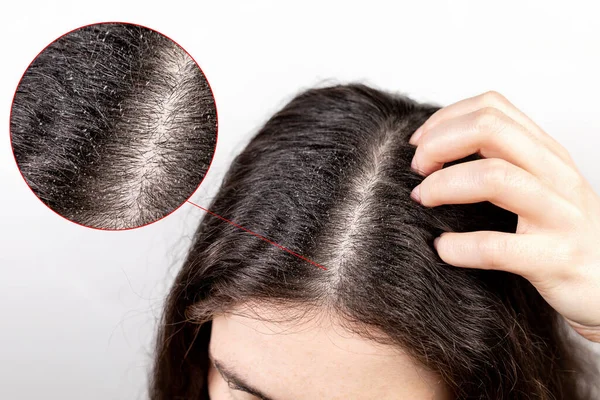 Wanita Itu Menggaruk Kepalanya Dengan Tangannya Menunjukkan Perpisahan Rambut Hitam — Stok Foto