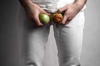 Üreme organı seviyesinde, olgun ve çürük bir elma tutan bir adam. Üreme sisteminde acı çeken bir erkek. Erkekler için hastalık. Cinsel yolla bulaşan enfeksiyonları koruma kavramı. Kapat..
