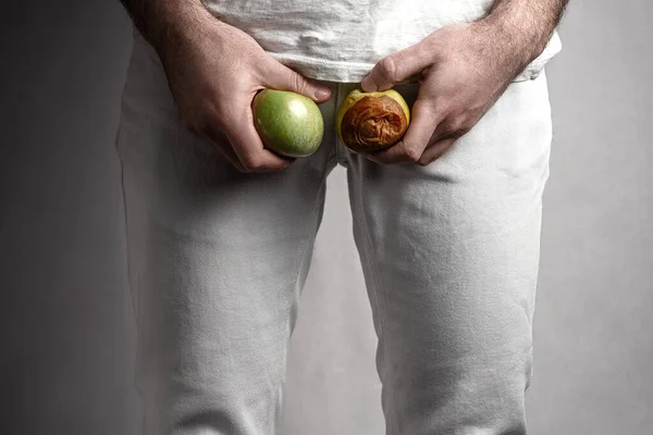 Man Level Genitals Holding Ripe Rotten Apple Male Suffering Pain — Stock Photo, Image