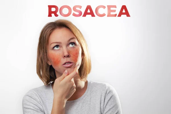 女性は炎症を起こした酒の頬と血管を持つブロンドです テキスト Rosacease 白い背景 — ストック写真