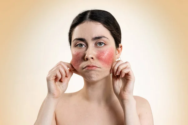 Portrait Distressed Caucasian Woman Pulling Skin Her Reddened Cheeks Her — Stock Photo, Image