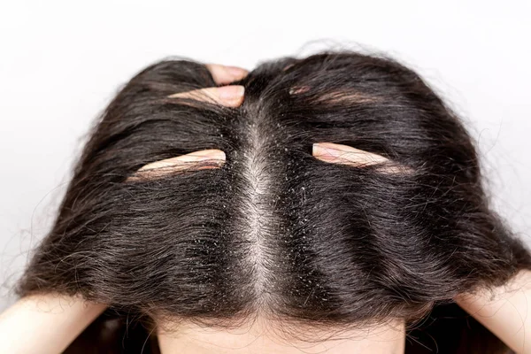 Wanita Itu Memegang Kepalanya Dengan Tangannya Menunjukkan Perpisahan Rambut Hitam — Stok Foto