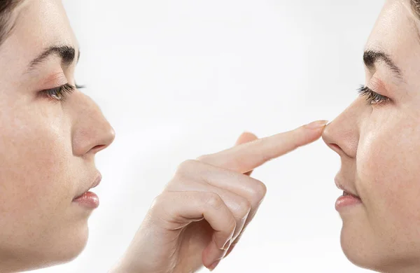 鼻成形术 两名女性面部特写 显示鼻整形术前后的结果 食指手指头在鼻尖上的食指 侧视图 白色背景 美容外科的概念 — 图库照片