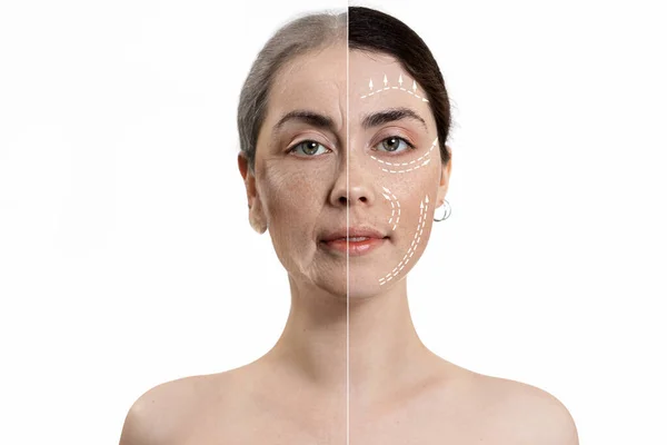 Kozmetik işlemlerden önce ve sonra sonuç. İki parçaya bölünmüş bir kadın portresi, genç ve yaşlı. Beyaz bir arka planda izole edilmiş. Yenilenme ve estetik ameliyat kavramı.