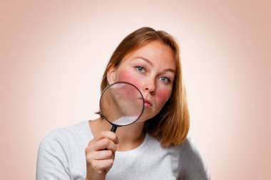 Yanaklarında kırmızılık gösteren bir kadının portresi, büyüteçle. Pembe arka plan. Rosacea konsepti.