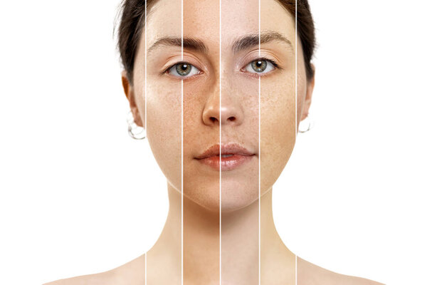 Портрет крупным планом брюнетки с другим цветом кожи. Изолированный на белом фоне. Концепция выбора основы косметики.