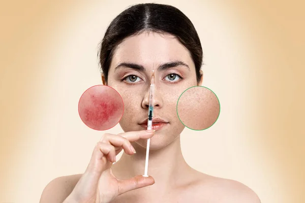 Portrait Beautiful Young Woman Holding Syringe Her Face Enlarged Circles — Stock Photo, Image