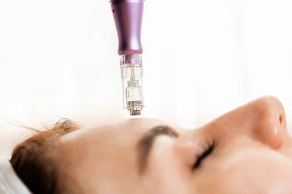 Concepto Cosmetológico Profesional Rejuvenecimiento Procedimiento Belleza Mesoterapia Fraccionada Cara Cliente — Foto de Stock