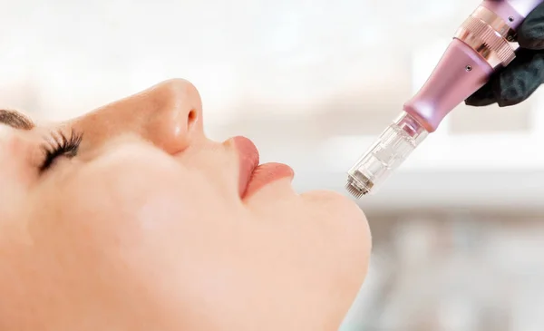 Tratamiento Belleza Cosmetología Profesional Procedimiento Rejuvenecimiento Mesoterapia Fraccionada Cara Cliente — Foto de Stock