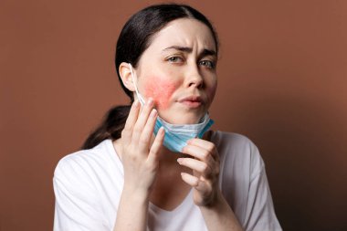Maskne. Kafkasyalı genç bir kadının portresi koruyucu maske takmaktan yanaklarında tahriş gösteriyor. Kahverengi arka plan. Rosacea ve alerji kavramı.