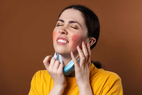 Rosacea Young Upset Woman Nervously Scratches Her Face Her Hands — Stock Photo, Image