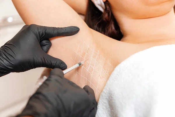 Cosmetologist Black Latex Gloves Makes Injection Botulinum Toxin Woman Axillary — Stock Photo, Image