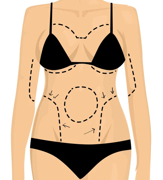 Kadın estetik ameliyat için hazırlanıyor