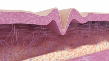 Skin rejuvenation.Medical 3d animation. Wrinkle-removing treatment. Cross-section of skin tissue with collagen and elastic fibers, fibroblasts, and hyaluronic acid cells before and after action anti-aging beauty products or cosmetological procedure.