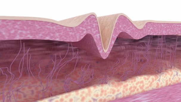 Skin Rejuvenation Medical Animation Wrinkle Removing Treatment Cross Section Skin — Αρχείο Βίντεο