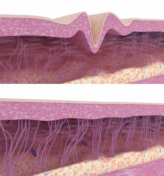 Cilt Tazeleme Kolajen Elastin Fiberler Yeniden Inşa Ediliyor Boyutlu Resimleme — Stok fotoğraf