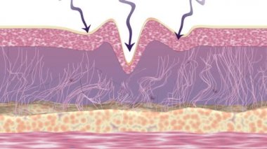 Wrinkle reduction and collagen regeneration. Skin rejuvenation treatment. 3D animation showing cross-section of skin tissue before and after the action of anti-aging cosmetics products.