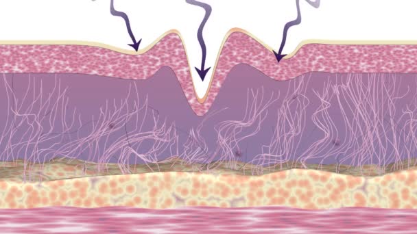 Wrinkle Reduction Collagen Regeneration Skin Rejuvenation Treatment Animation Showing Cross — 비디오