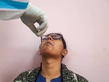 Tıbbi teknisyenlerin eldivenli elleri tarafından kadın bir morina hastasından alınan burun temizleme bezi..