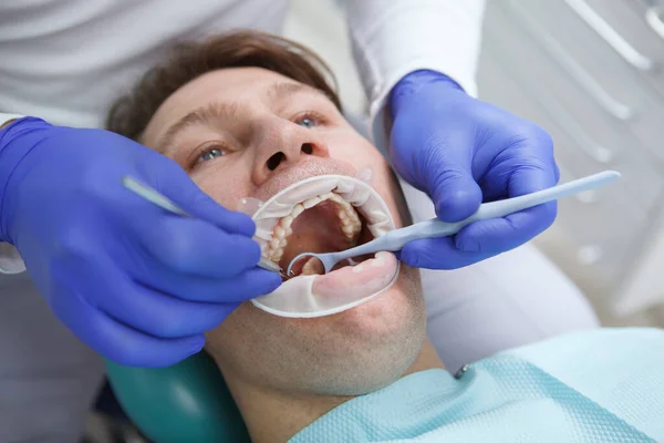 Zbliżenie Mężczyzny Którego Zęby Bada Profesjonalny Dentysta — Zdjęcie stockowe