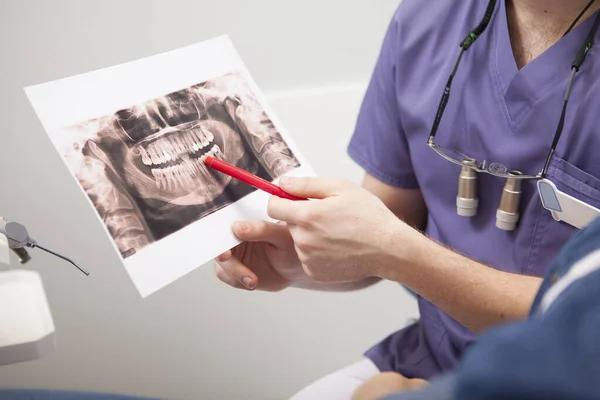 Nierozpoznany Dentysta Pokazujący Pacjentowi Prześwietlenie Stomatologiczne — Zdjęcie stockowe