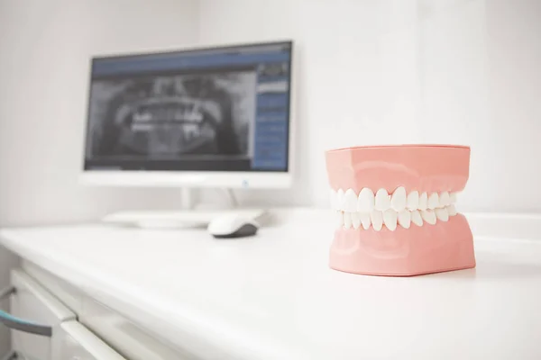 Jaw model at dental clinic, x-ray scan on computer on background