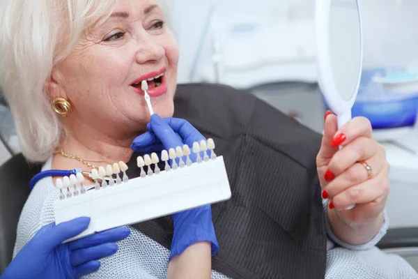 Zbliżenie Starszej Kobiety Wybierającej Odcień Wybielania Zębów Klinice Stomatologicznej — Zdjęcie stockowe