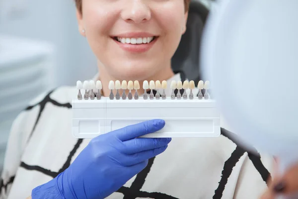 Cropped Close Dentista Segurando Dentes Branqueamento Sombra Guia Perto Pacientes — Fotografia de Stock