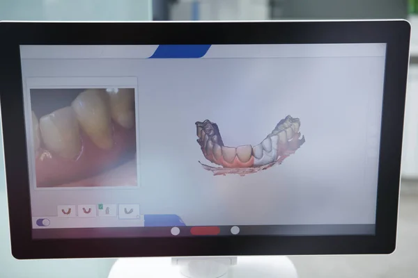 İşyerinde diş hekimi intraoral tarayıcı kullanıyor