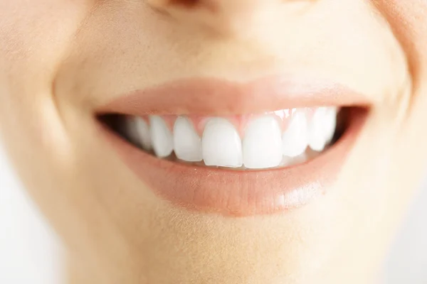 Kvinnan leende visar vita rena tänder — Stockfoto
