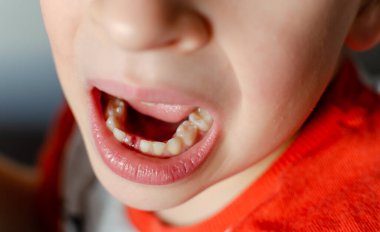 Bir çocuk süt dişini, deliğini, ağız temizliği konseptini kaybetmiş.