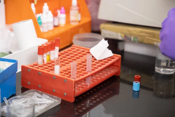 Blodd örnekleri toplamak için bir sürü ilaç test tüpü. Teşhis koymak için, aşı araştırması için, tıbbi geçmiş için. Boşluğu kopyala,