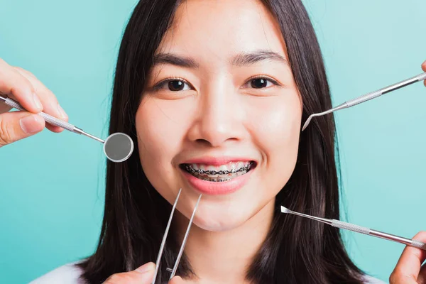 Asiatiska Tonåring Vacker Ung Kvinna Leende Har Tandställning Tänderna Skrattar — Stockfoto