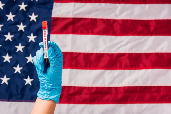 Hands Doctor Wearing Gloves Holding Blood Test Tube Coronavirus Covid — Stock Photo, Image