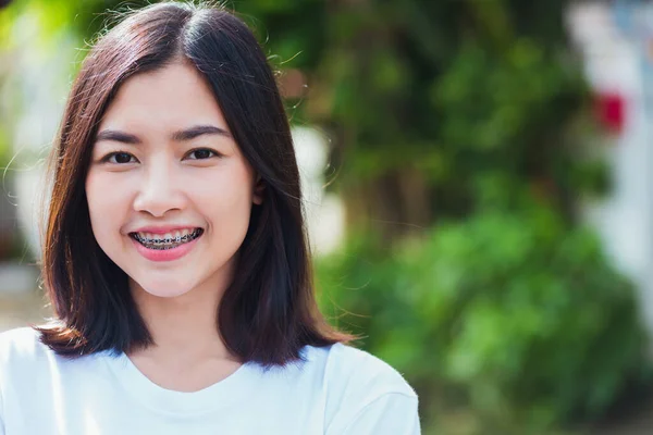 Asyalı Genç Güzel Kadın Gülümsemesinin Diş Telleri Açık Havada Gülüşmeler — Stok fotoğraf