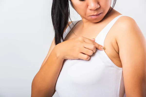 Close Asian Woman Pointing Her Skin Underarm She Problem Armpit — Stock Photo, Image