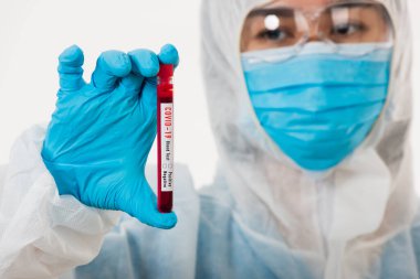 PPE üniformalı tıp bilimcileri, Coronavirus test tüpü taşıyan bir maske takıyor. Bir hastane laboratuvarında, beyaz, ilaç COVID-19 salgın konseptini analiz etmek için kullanılan bir kan örneği.