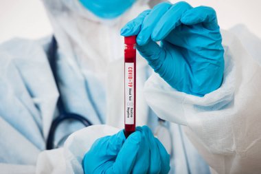 PPE üniformalı tıp bilimcileri, Coronavirus test tüpü taşıyan bir maske takıyor. Bir hastane laboratuvarında, beyaz, ilaç COVID-19 salgın konseptini analiz etmek için kullanılan bir kan örneği.