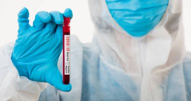 PPE üniformalı tıp bilimcileri, Coronavirus test tüpü taşıyan bir maske takıyor. Bir hastane laboratuvarında, beyaz, ilaç COVID-19 salgın konseptini analiz etmek için kullanılan bir kan örneği.