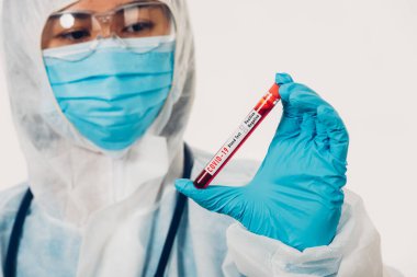 PPE üniformalı tıp bilimcileri, Coronavirus test tüpü taşıyan bir maske takıyor. Bir hastane laboratuvarında, beyaz, ilaç COVID-19 salgın konseptini analiz etmek için kullanılan bir kan örneği.